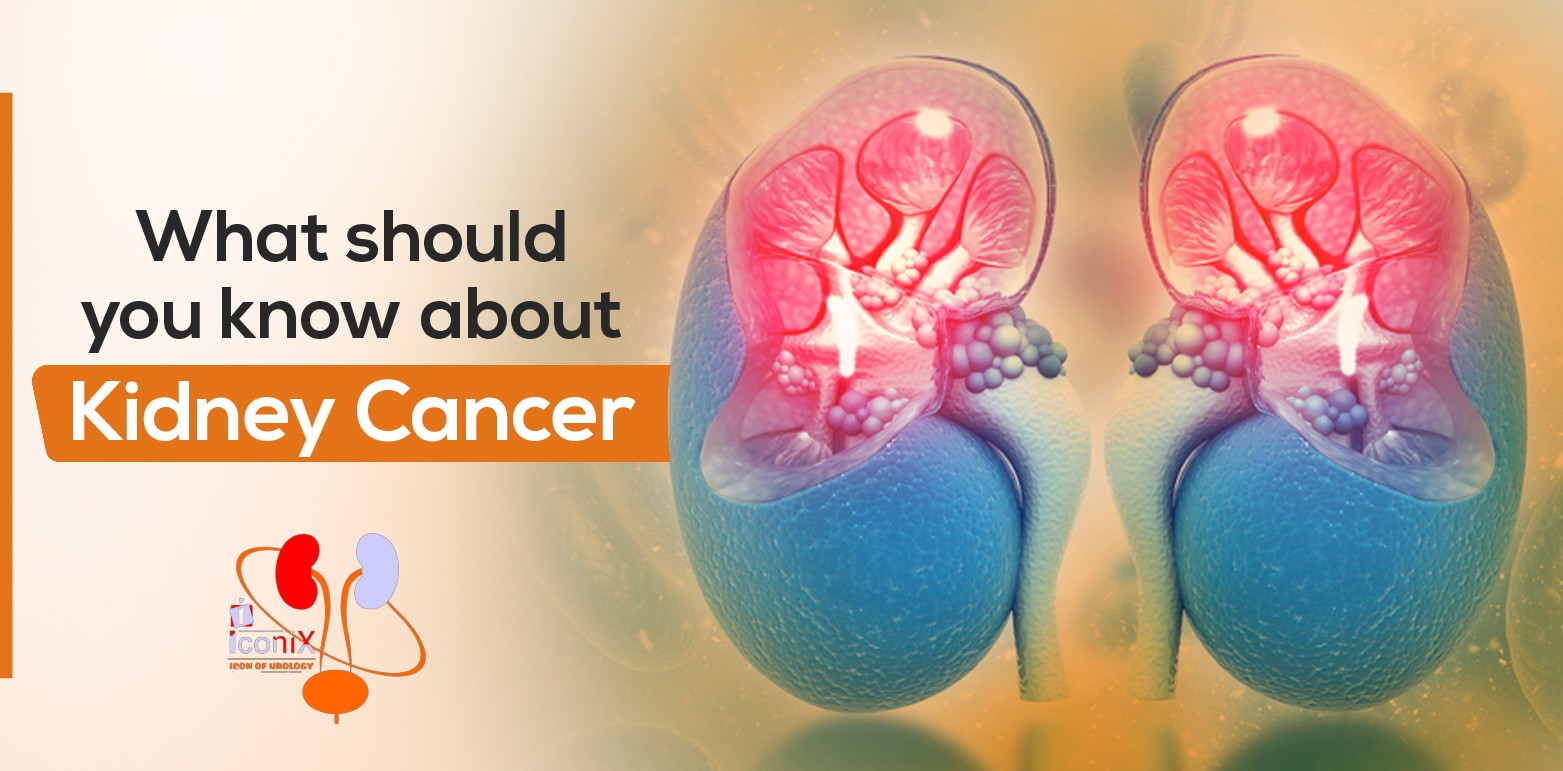 what should you know about kidney cancer